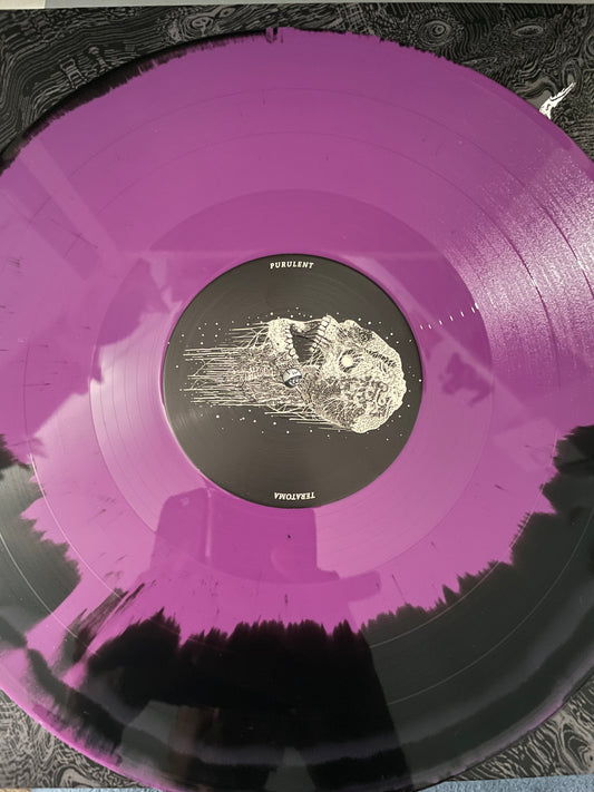 Teratoma - Purulent Manifestations LP